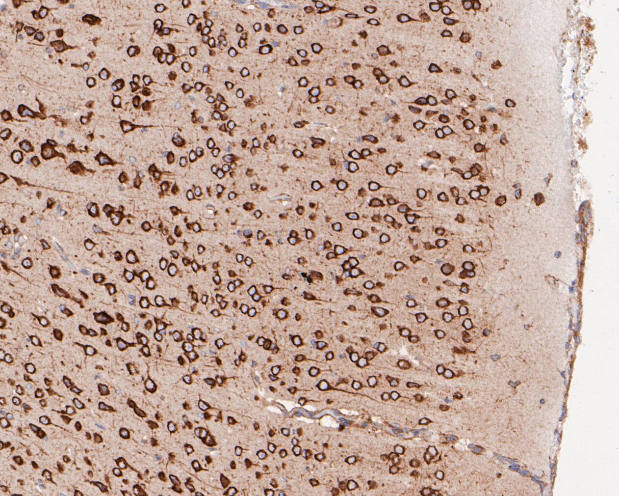 Immunohistochemical analysis of paraffin-embedded mouse brain tissue using anti-Elongation factor 1-gamma antibody. The section was pre-treated using heat mediated antigen retrieval with sodium citrate buffer (pH 6.0) for 20 minutes. The tissues were blocked in 5% BSA for 30 minutes at room temperature, washed with ddH2O and PBS, and then probed with the primary antibody (ET7110-45, 1/400)  for 30 minutes at room temperature. The detection was performed using an HRP conjugated compact polymer system. DAB was used as the chromogen. Tissues were counterstained with hematoxylin and mounted with DPX.