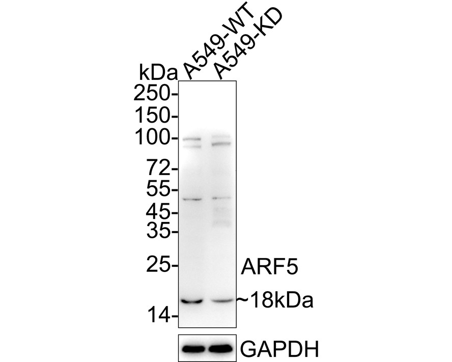 Western blot analysis of ARF5 on HepG2 cell lysate. Proteins were transferred to a PVDF membrane and blocked with 5% BSA in PBS for 1 hour at room temperature. The primary antibody (ET7110-46, 1/500) was used in 5% BSA at room temperature for 2 hours. Goat Anti-Rabbit IgG - HRP Secondary Antibody (HA1001) at 1:5,000 dilution was used for 1 hour at room temperature.