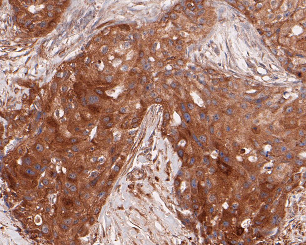Immunohistochemical analysis of paraffin-embedded mouse lung tissue using anti-ARF5 antibody. The section was pre-treated using heat mediated antigen retrieval with Tris-EDTA buffer (pH 8.0-8.4) for 20 minutes.The tissues were blocked in 5% BSA for 30 minutes at room temperature, washed with ddH2O and PBS, and then probed with the primary antibody (ET7110-46, 1/50) for 30 minutes at room temperature. The detection was performed using an HRP conjugated compact polymer system. DAB was used as the chromogen. Tissues were counterstained with hematoxylin and mounted with DPX.