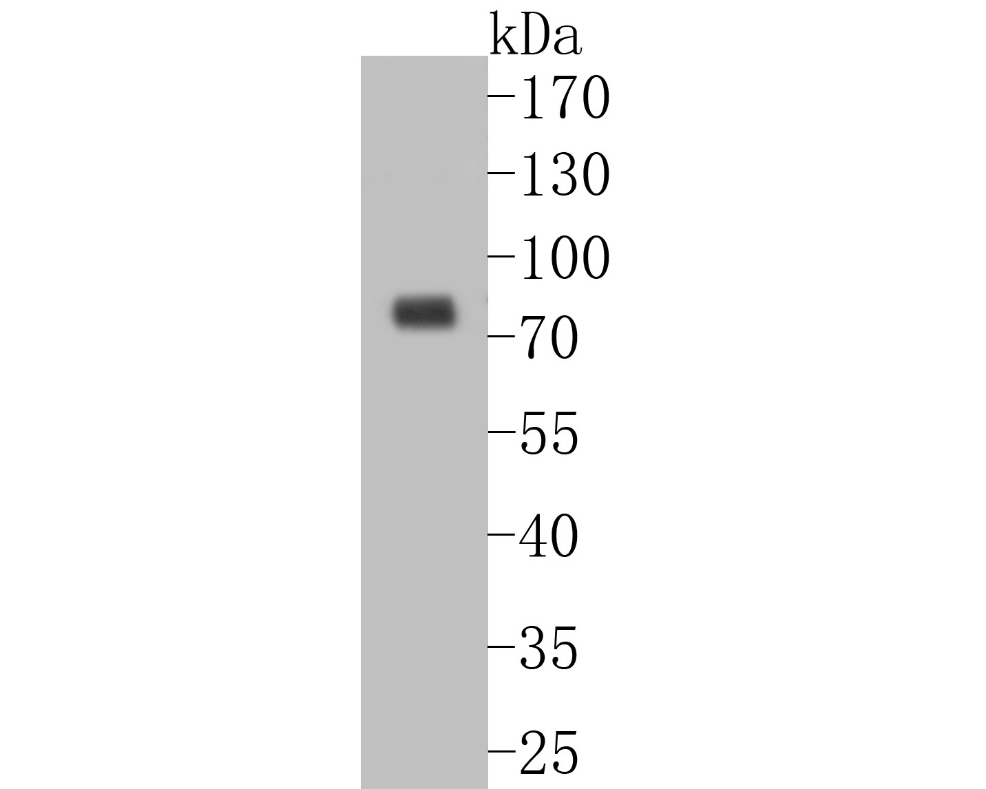 Western blot analysis of p63 on human skin tissue lysates. Proteins were transferred to a PVDF membrane and blocked with 5% BSA in PBS for 1 hour at room temperature. The primary antibody (ET7110-47, 1/500) was used in 5% BSA at room temperature for 2 hours. Goat Anti-Rabbit IgG - HRP Secondary Antibody (HA1001) at 1:5,000 dilution was used for 1 hour at room temperature.