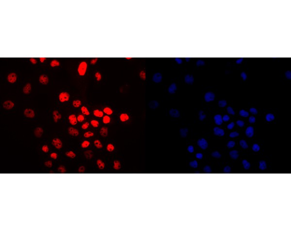 ICC staining of p63 in A431 cells (red). Formalin fixed cells were permeabilized with 0.1% Triton X-100 in TBS for 10 minutes at room temperature and blocked with 1% Blocker BSA for 15 minutes at room temperature. Cells were probed with the primary antibody (ET7110-47, 1/200) for 1 hour at room temperature, washed with PBS. Alexa Fluor®594 Goat anti-Rabbit IgG was used as the secondary antibody at 1/1,000 dilution. The nuclear counter stain is DAPI (blue).