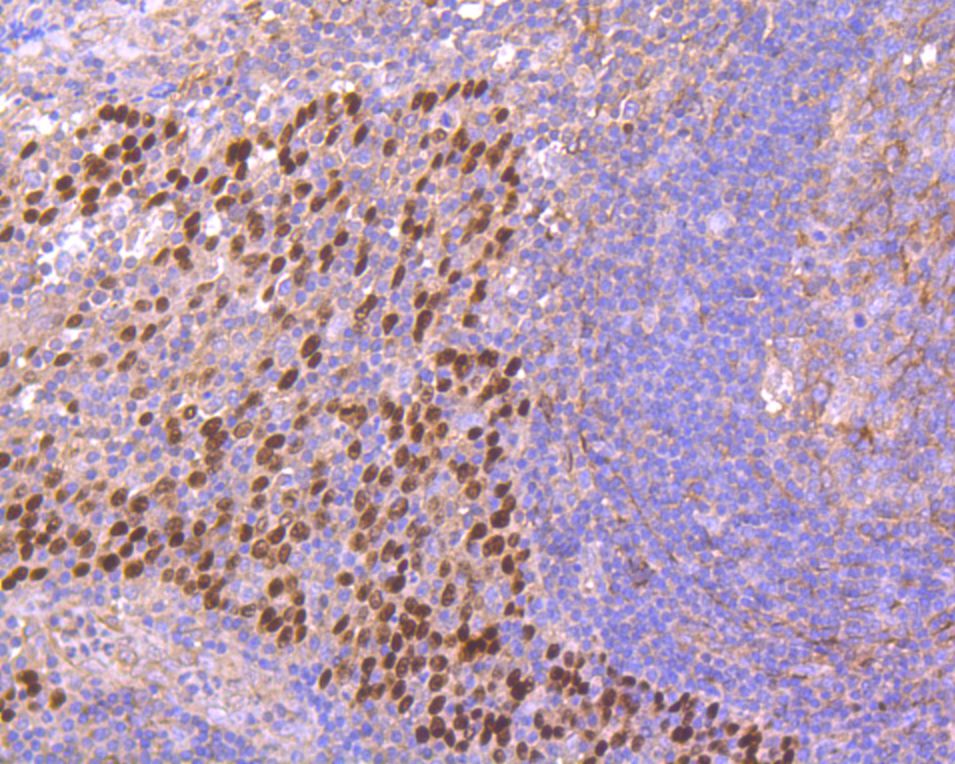 Immunohistochemical analysis of paraffin-embedded human tonsil tissue using anti-p63 antibody. The section was pre-treated using heat mediated antigen retrieval with Tris-EDTA buffer (pH 8.0-8.4) for 20 minutes.The tissues were blocked in 5% BSA for 30 minutes at room temperature, washed with ddH2O and PBS, and then probed with the primary antibody (ET7110-47, 1/200) for 30 minutes at room temperature. The detection was performed using an HRP conjugated compact polymer system. DAB was used as the chromogen. Tissues were counterstained with hematoxylin and mounted with DPX.