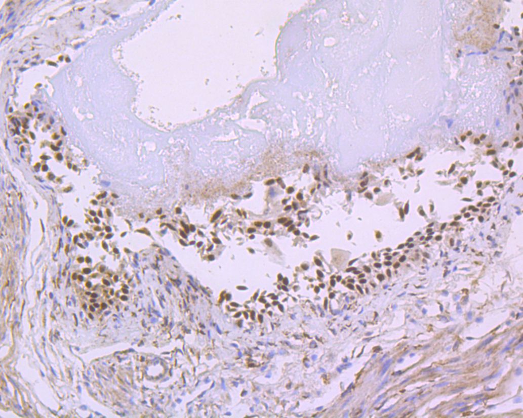 Immunohistochemical analysis of paraffin-embedded mouse prostate tissue using anti-p63 antibody. The section was pre-treated using heat mediated antigen retrieval with Tris-EDTA buffer (pH 8.0-8.4) for 20 minutes.The tissues were blocked in 5% BSA for 30 minutes at room temperature, washed with ddH2O and PBS, and then probed with the primary antibody (ET7110-47, 1/200) for 30 minutes at room temperature. The detection was performed using an HRP conjugated compact polymer system. DAB was used as the chromogen. Tissues were counterstained with hematoxylin and mounted with DPX.