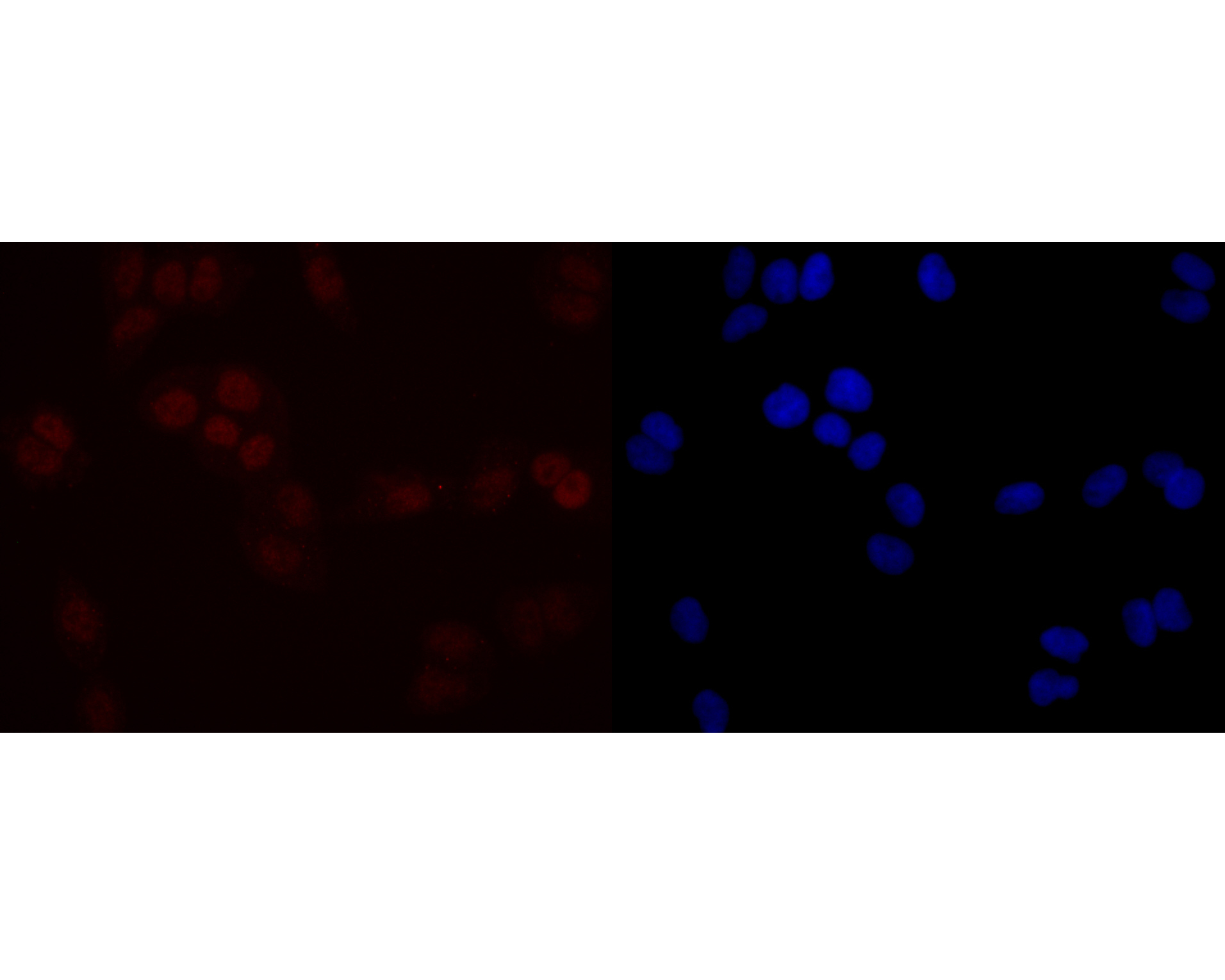 ICC staining of SIRT1 in Hela cells (red). Formalin fixed cells were permeabilized with 0.1% Triton X-100 in TBS for 10 minutes at room temperature and blocked with 1% Blocker BSA for 15 minutes at room temperature. Cells were probed with the primary antibody (ET7110-49, 1/50) for 1 hour at room temperature, washed with PBS. Alexa Fluor®594 Goat anti-Rabbit IgG was used as the secondary antibody at 1/1,000 dilution. The nuclear counter stain is DAPI (blue).