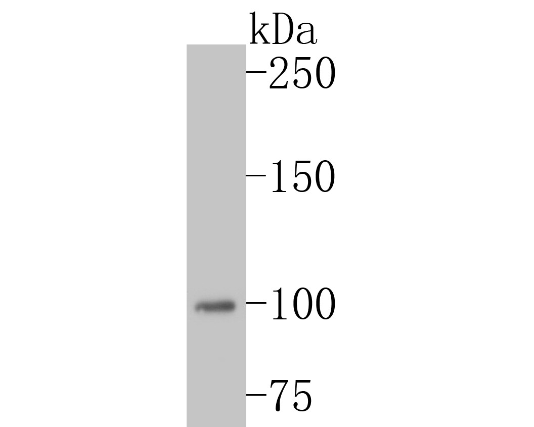 Western blot analysis of MSH2 on HL-60 cell lysates. Proteins were transferred to a PVDF membrane and blocked with 5% BSA in PBS for 1 hour at room temperature. The primary antibody (ET7110-50, 1/500) was used in 5% BSA at room temperature for 2 hours. Goat Anti-Rabbit IgG - HRP Secondary Antibody (HA1001) at 1:5,000 dilution was used for 1 hour at room temperature.
