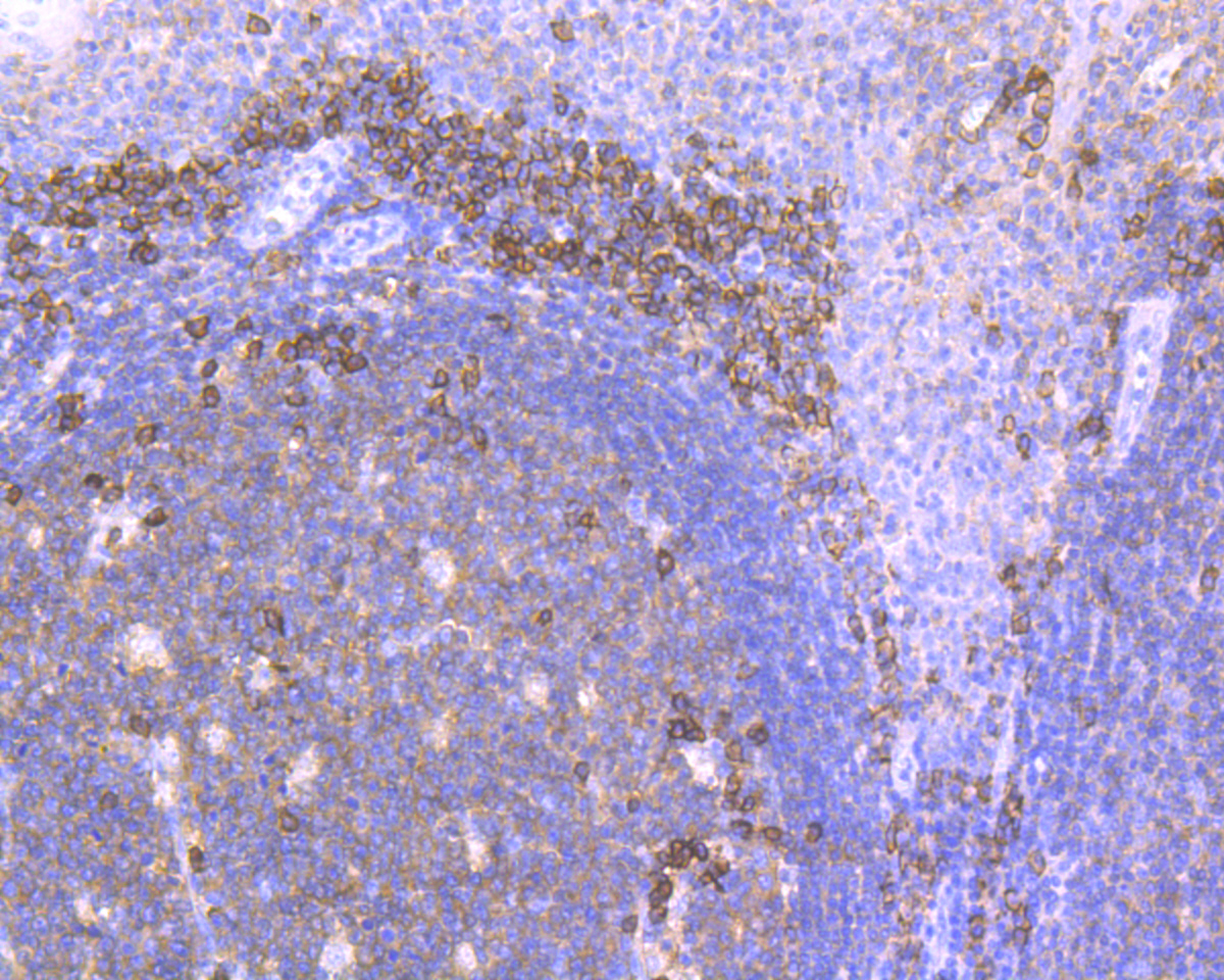 Immunohistochemical analysis of paraffin-embedded human tonsil tissue using anti-CD38 antibody. The section was pre-treated using heat mediated antigen retrieval with Tris-EDTA buffer (pH 8.0-8.4) for 20 minutes.The tissues were blocked in 5% BSA for 30 minutes at room temperature, washed with ddH2O and PBS, and then probed with the primary antibody (ET7110-53, 1/200) for 30 minutes at room temperature. The detection was performed using an HRP conjugated compact polymer system. DAB was used as the chromogen. Tissues were counterstained with hematoxylin and mounted with DPX.