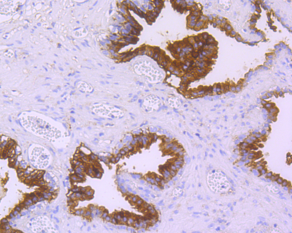 Immunohistochemical analysis of paraffin-embedded human prostate tissue using anti-CD38 antibody. The section was pre-treated using heat mediated antigen retrieval with Tris-EDTA buffer (pH 8.0-8.4) for 20 minutes.The tissues were blocked in 5% BSA for 30 minutes at room temperature, washed with ddH2O and PBS, and then probed with the primary antibody (ET7110-53, 1/200) for 30 minutes at room temperature. The detection was performed using an HRP conjugated compact polymer system. DAB was used as the chromogen. Tissues were counterstained with hematoxylin and mounted with DPX.