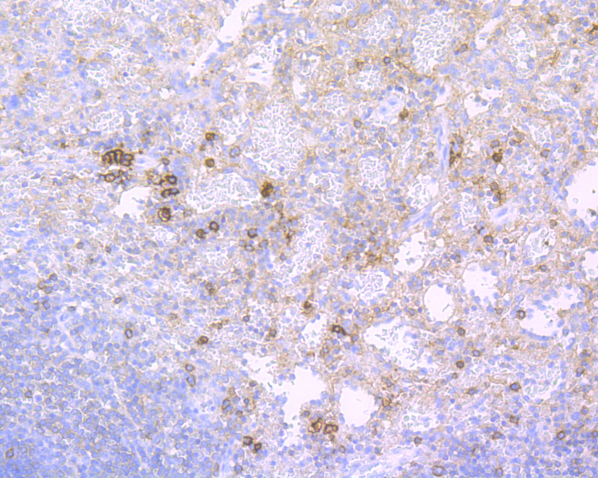 Immunohistochemical analysis of paraffin-embedded human spleen tissue using anti-CD38 antibody. The section was pre-treated using heat mediated antigen retrieval with Tris-EDTA buffer (pH 8.0-8.4) for 20 minutes.The tissues were blocked in 5% BSA for 30 minutes at room temperature, washed with ddH2O and PBS, and then probed with the primary antibody (ET7110-53, 1/200) for 30 minutes at room temperature. The detection was performed using an HRP conjugated compact polymer system. DAB was used as the chromogen. Tissues were counterstained with hematoxylin and mounted with DPX.