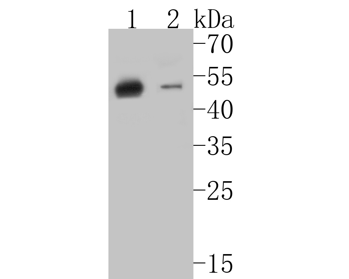 Western blot analysis of Cytokeratin 20 on different lysates. Proteins were transferred to a PVDF membrane and blocked with 5% BSA in PBS for 1 hour at room temperature. The primary antibody (ET7110-54, 1/500) was used in 5% BSA at room temperature for 2 hours. Goat Anti-Rabbit IgG - HRP Secondary Antibody (HA1001) at 1:5,000 dilution was used for 1 hour at room temperature.<br />
Positive control: <br />
Lane 1: human stomach tissue lysate<br />
Lane 2: SK-Br-3 cell lysate