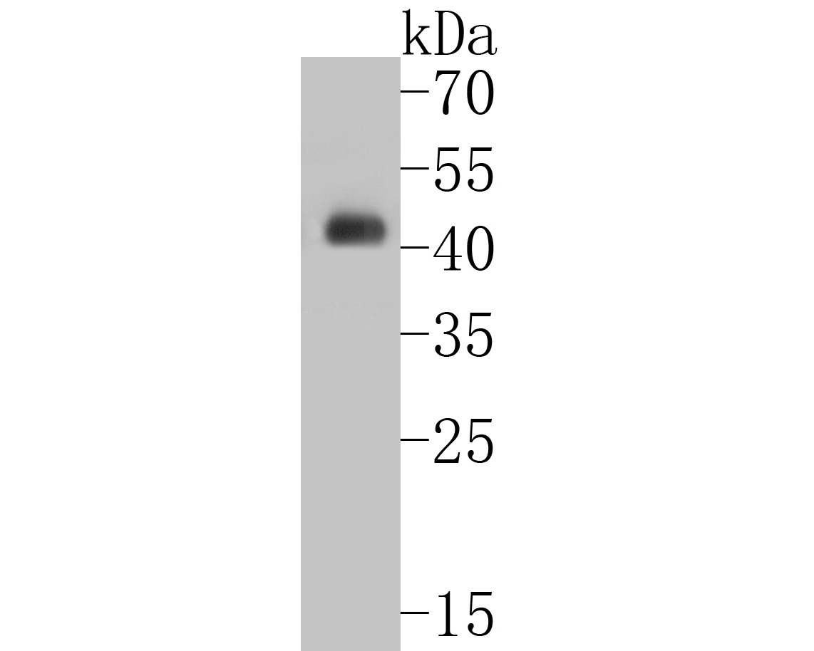 Western blot analysis of Cytokeratin 20 on human small intestine tissue lysates. Proteins were transferred to a PVDF membrane and blocked with 5% BSA in PBS for 1 hour at room temperature. The primary antibody (ET7110-54, 1/5000) was used in 5% BSA at room temperature for 2 hours. Goat Anti-Rabbit IgG - HRP Secondary Antibody (HA1001) at 1:5,000 dilution was used for 1 hour at room temperature.