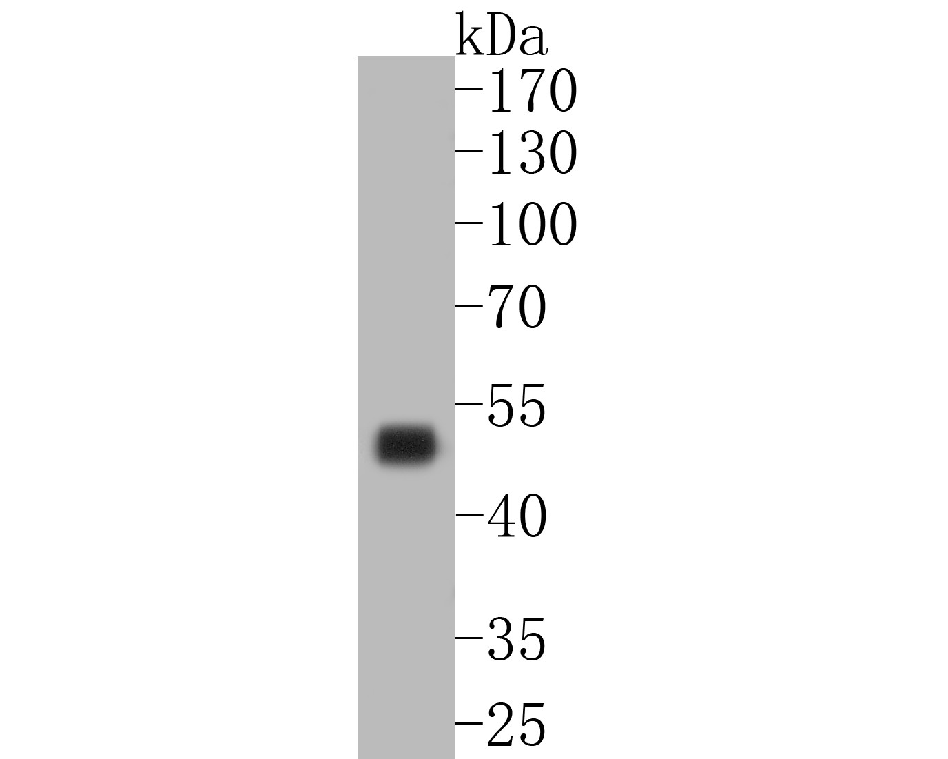 Western blot analysis of CD5 on human skin tissue lysates. Proteins were transferred to a PVDF membrane and blocked with 5% BSA in PBS for 1 hour at room temperature. The primary antibody (ET7110-56, 1/500) was used in 5% BSA at room temperature for 2 hours. Goat Anti-Rabbit IgG - HRP Secondary Antibody (HA1001) at 1:5,000 dilution was used for 1 hour at room temperature.