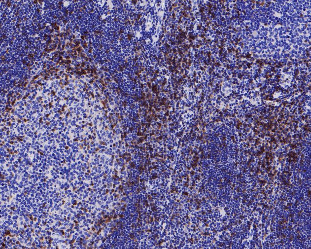 Immunohistochemical analysis of paraffin-embedded human tonsil tissue using anti-CD5 antibody. The section was pre-treated using heat mediated antigen retrieval with Tris-EDTA buffer (pH 8.0-8.4) for 20 minutes.The tissues were blocked in 5% BSA for 30 minutes at room temperature, washed with ddH2O and PBS, and then probed with the primary antibody (ET7110-56, 1/200) for 30 minutes at room temperature. The detection was performed using an HRP conjugated compact polymer system. DAB was used as the chromogen. Tissues were counterstained with hematoxylin and mounted with DPX.