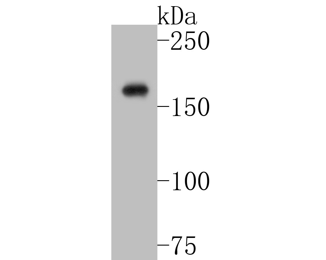 Western blot analysis of Neurocan on SiHa cell lysates. Proteins were transferred to a PVDF membrane and blocked with 5% BSA in PBS for 1 hour at room temperature. The primary antibody (ET7110-59, 1/500) was used in 5% BSA at room temperature for 2 hours. Goat Anti-Rabbit IgG - HRP Secondary Antibody (HA1001) at 1:200,000 dilution was used for 1 hour at room temperature.