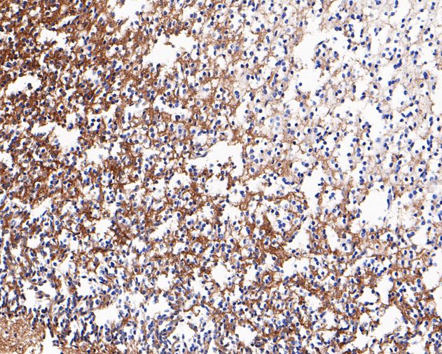 Immunohistochemical analysis of paraffin-embedded human brain tissue using anti-Neurocan antibody. The section was pre-treated using heat mediated antigen retrieval with Tris-EDTA buffer (pH 9.0) for 20 minutes.The tissues were blocked in 5% BSA for 30 minutes at room temperature, washed with ddH2O and PBS, and then probed with the primary antibody (ET7110-59, 1/200) for 30 minutes at room temperature. The detection was performed using an HRP conjugated compact polymer system. DAB was used as the chromogen. Tissues were counterstained with hematoxylin and mounted with DPX.