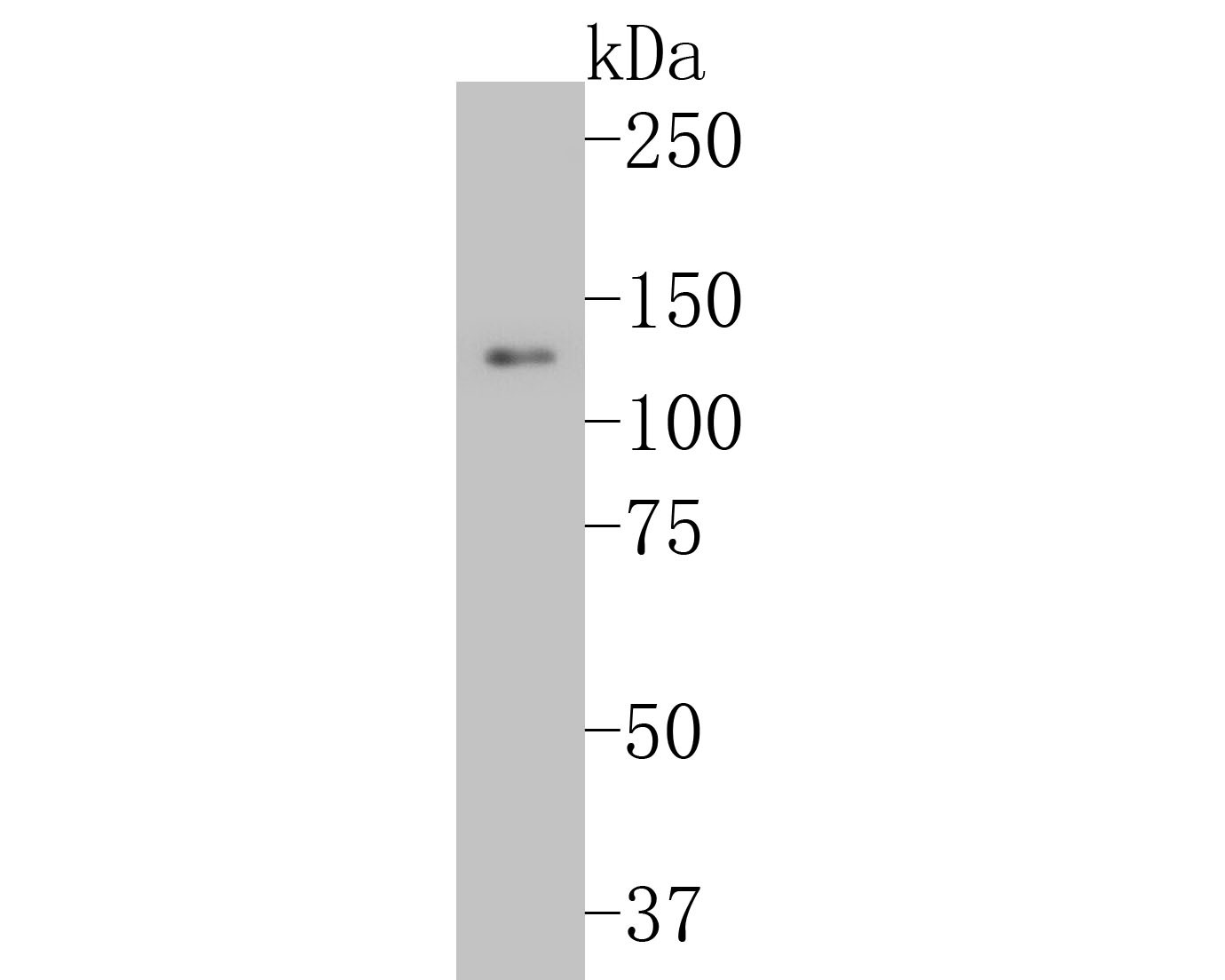 Western blot analysis of Integrin beta 3 on HUVEC cell lysates. Proteins were transferred to a PVDF membrane and blocked with 5% BSA in PBS for 1 hour at room temperature. The primary antibody (ET7110-61, 1/500) was used in 5% BSA at room temperature for 2 hours. Goat Anti-Rabbit IgG - HRP Secondary Antibody (HA1001) at 1:5,000 dilution was used for 1 hour at room temperature.