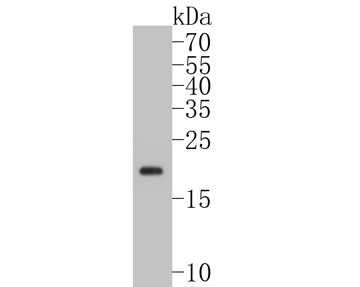 Western blot analysis of CD3 epsilon on Jurkat cell lysates with Rabbit anti-CD3 epsilon antibody (ET7110-63) at 1/500 dilution.<br />
<br />
Lysates/proteins at 10 µg/Lane.<br />
<br />
Predicted band size: 23 kDa<br />
Observed band size:23 kDa<br />
<br />
Exposure time: 2 minutes;<br />
<br />
Proteins were transferred to a PVDF membrane and blocked with 5% NFDM/TBST for 1 hour at room temperature. The primary antibody (ET7110-63) at 1/500 dilution was used in 5% NFDM/TBST at room temperature for 2 hours. Goat Anti-Rabbit IgG - HRP Secondary Antibody (HA1001) at 1:5,000 dilution was used for 1 hour at room temperature.
