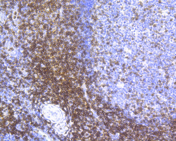 Immunohistochemical analysis of paraffin-embedded human tonsil tissue with Rabbit anti-CD3 epsilon antibody (ET7110-63) at 1/200 dilution.<br />
<br />
The section was pre-treated using heat mediated antigen retrieval with Tris-EDTA buffer (pH 8.0-8.4) for 20 minutes. The tissues were blocked in 1% BSA for 20 minutes at room temperature, washed with ddH2O and PBS, and then probed with the primary antibody (ET7110-63) at 1/200 dilution for 1 hour at room temperature. The detection was performed using an HRP conjugated compact polymer system. DAB was used as the chromogen. Tissues were counterstained with hematoxylin and mounted with DPX..