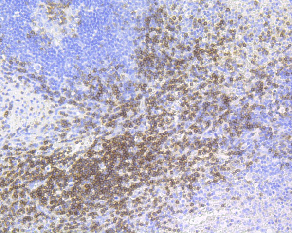 Immunohistochemical analysis of paraffin-embedded human spleen tissue with Rabbit anti-CD3 epsilon antibody (ET7110-63) at 1/200 dilution.<br />
<br />
The section was pre-treated using heat mediated antigen retrieval with Tris-EDTA buffer (pH 8.0-8.4) for 20 minutes. The tissues were blocked in 1% BSA for 20 minutes at room temperature, washed with ddH2O and PBS, and then probed with the primary antibody (ET7110-63) at 1/200 dilution for 1 hour at room temperature. The detection was performed using an HRP conjugated compact polymer system. DAB was used as the chromogen. Tissues were counterstained with hematoxylin and mounted with DPX.