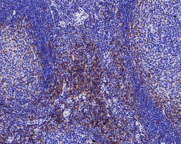 Immunohistochemical analysis of paraffin-embedded human tonsil tissue with Rabbit anti-CD4 antibody (ET7110-64) at 1/200 dilution.<br />
<br />
The section was pre-treated using heat mediated antigen retrieval with Tris-EDTA buffer (pH 8.0-8.4) for 20 minutes. The tissues were blocked in 1% BSA for 20 minutes at room temperature, washed with ddH2O and PBS, and then probed with the primary antibody (ET7110-64) at 1/200 dilution for 1 hour at room temperature. The detection was performed using an HRP conjugated compact polymer system. DAB was used as the chromogen. Tissues were counterstained with hematoxylin and mounted with DPX.
