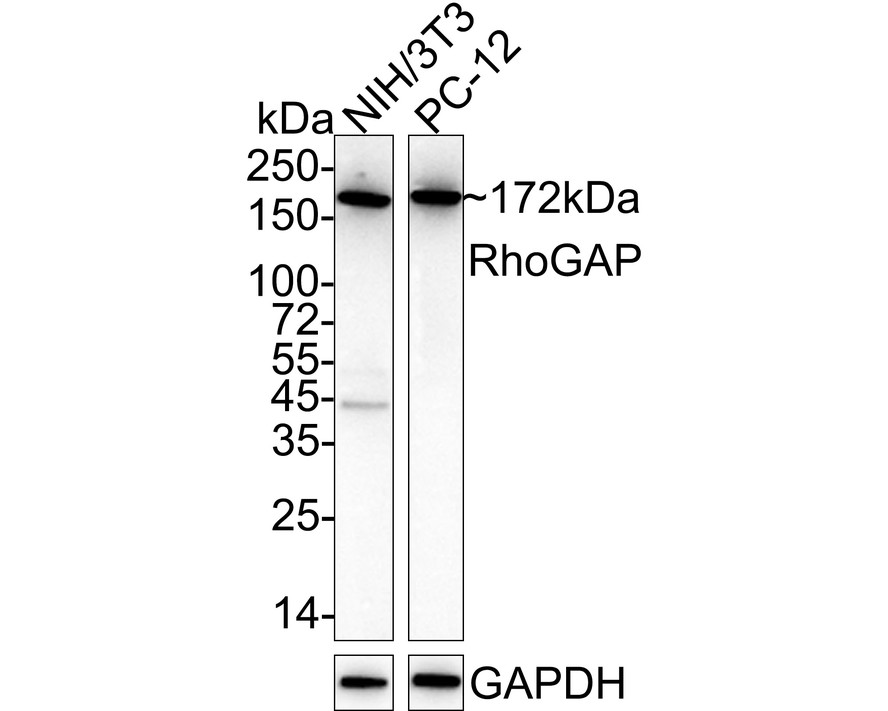 Western blot analysis of RhoGAP on different lysates with Rabbit anti-RhoGAP antibody (ET7110-65) at 1/500 dilution.<br />
<br />
Lane 1: SiHa cell lysate<br />
Lane 2: HepG2 cell lysate<br />
<br />
Lysates/proteins at 10 µg/Lane.<br />
<br />
Predicted band size: 172 kDa<br />
Observed band size: 172 kDa<br />
<br />
Exposure time: 2 minutes;<br />
<br />
6% SDS-PAGE gel.<br />
<br />
Proteins were transferred to a PVDF membrane and blocked with 5% NFDM/TBST for 1 hour at room temperature. The primary antibody (ET7110-65) at 1/500 dilution was used in 5% NFDM/TBST at room temperature for 2 hours. Goat Anti-Rabbit IgG - HRP Secondary Antibody (HA1001) at 1:300,000 dilution was used for 1 hour at room temperature.