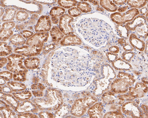 Immunohistochemical analysis of paraffin-embedded human kidney tissue with Rabbit anti-Beta glucuronidase antibody (ET7110-66) at 1/200 dilution.<br />
<br />
The section was pre-treated using heat mediated antigen retrieval with Tris-EDTA buffer (pH 8.0-8.4) for 20 minutes. The tissues were blocked in 1% BSA for 20 minutes at room temperature, washed with ddH2O and PBS, and then probed with the primary antibody (ET7110-66) at 1/200 dilution for 1 hour at room temperature. The detection was performed using an HRP conjugated compact polymer system. DAB was used as the chromogen. Tissues were counterstained with hematoxylin and mounted with DPX.