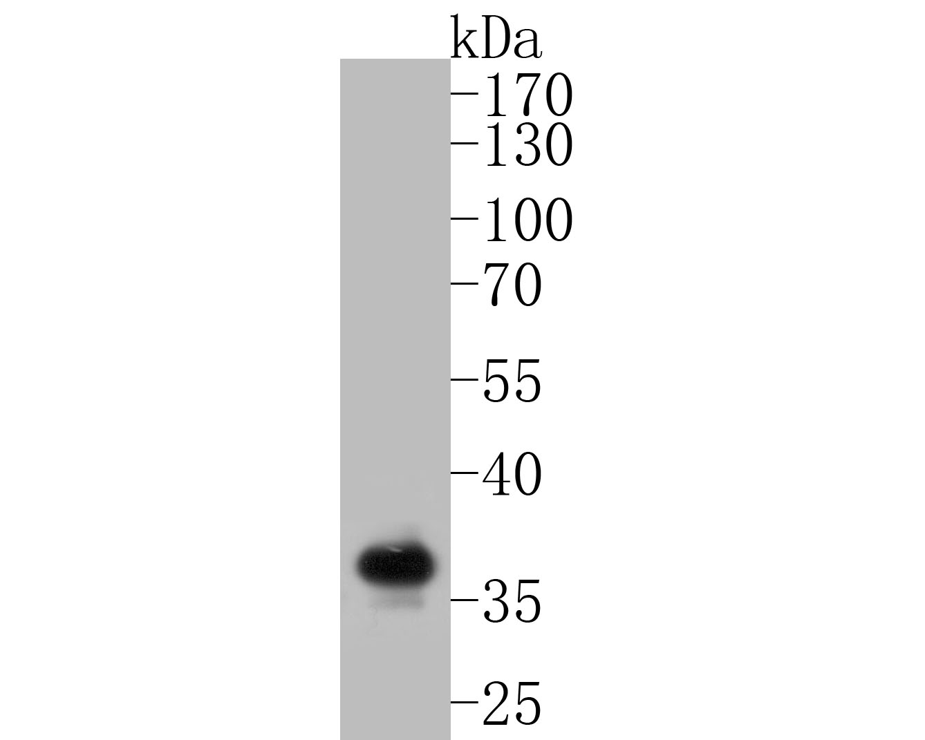 Western blot analysis of Syntaxin 1a on mouse bone marrow tissue lysates. Proteins were transferred to a PVDF membrane and blocked with 5% BSA in PBS for 1 hour at room temperature. The primary antibody (ET7110-68, 1/500) was used in 5% BSA at room temperature for 2 hours. Goat Anti-Rabbit IgG - HRP Secondary Antibody (HA1001) at 1:5,000 dilution was used for 1 hour at room temperature.