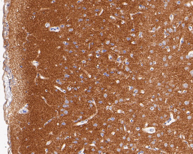 Immunohistochemical analysis of paraffin-embedded rat brain tissue with Rabbit anti-Syntaxin 1a antibody (ET7110-68) at 1/50 dilution.<br />
<br />
The section was pre-treated using heat mediated antigen retrieval with Tris-EDTA buffer (pH 8.0-8.4) for 20 minutes. The tissues were blocked in 1% BSA for 20 minutes at room temperature, washed with ddH2O and PBS, and then probed with the primary antibody (ET7110-68) at 1/50 dilution for 0.5 hour at room temperature. The detection was performed using an HRP conjugated compact polymer system. DAB was used as the chromogen. Tissues were counterstained with hematoxylin and mounted with DPX.