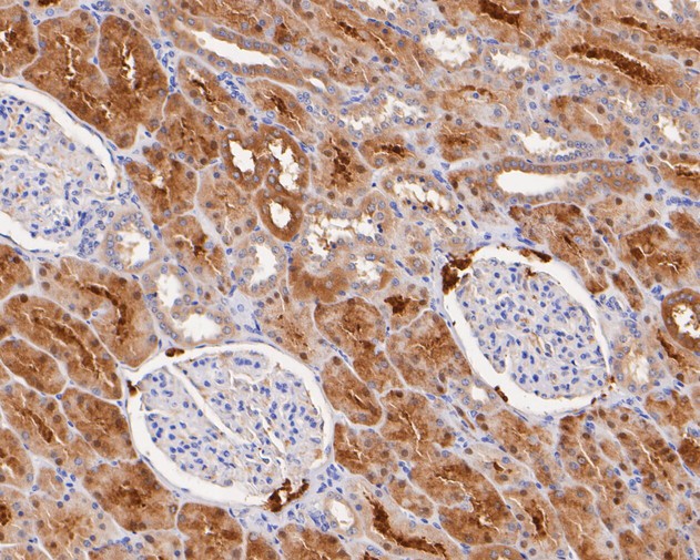 Immunohistochemical analysis of paraffin-embedded human kidney tissue with Rabbit anti-Syntaxin 1a antibody (ET7110-68) at 1/50 dilution.<br />
<br />
The section was pre-treated using heat mediated antigen retrieval with Tris-EDTA buffer (pH 8.0-8.4) for 20 minutes. The tissues were blocked in 1% BSA for 20 minutes at room temperature, washed with ddH2O and PBS, and then probed with the primary antibody (ET7110-68) at 1/50 dilution for 0.5 hour at room temperature. The detection was performed using an HRP conjugated compact polymer system. DAB was used as the chromogen. Tissues were counterstained with hematoxylin and mounted with DPX.