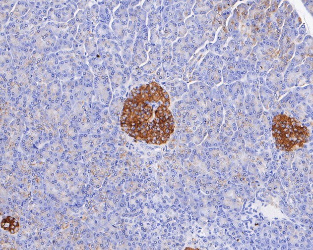 Immunohistochemical analysis of paraffin-embedded human pancreas tissue with Rabbit anti-Syntaxin 1a antibody (ET7110-68) at 1/200 dilution.<br />
<br />
The section was pre-treated using heat mediated antigen retrieval with Tris-EDTA buffer (pH 8.0-8.4) for 20 minutes. The tissues were blocked in 1% BSA for 20 minutes at room temperature, washed with ddH2O and PBS, and then probed with the primary antibody (ET7110-68) at 1/200 dilution for 0.5 hour at room temperature. The detection was performed using an HRP conjugated compact polymer system. DAB was used as the chromogen. Tissues were counterstained with hematoxylin and mounted with DPX.