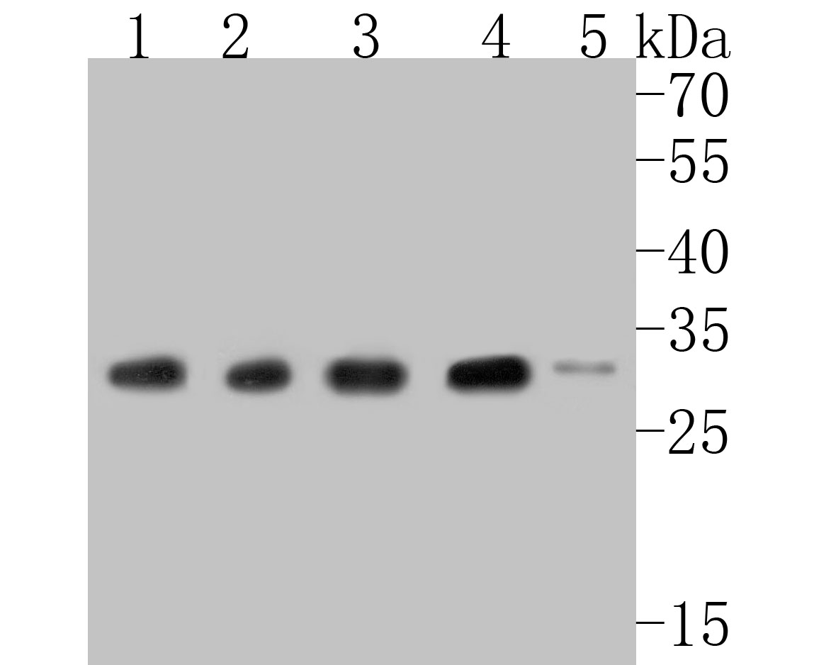 Western blot analysis of RPL7A on different lysates. Proteins were transferred to a PVDF membrane and blocked with 5% BSA in PBS for 1 hour at room temperature. The primary antibody (ET7110-70, 1/500) was used in 5% BSA at room temperature for 2 hours. Goat Anti-Rabbit IgG - HRP Secondary Antibody (HA1001) at 1:5,000 dilution was used for 1 hour at room temperature.<br />
Positive control: <br />
Lane 1: A431 cell lysate<br />
Lane 2: Jurkat cell lysate<br />
Lane 3: Raji cell lysate<br />
Lane 4: NIH/3T3 cell lysate<br />
Lane 5: C2C12 cell lysate