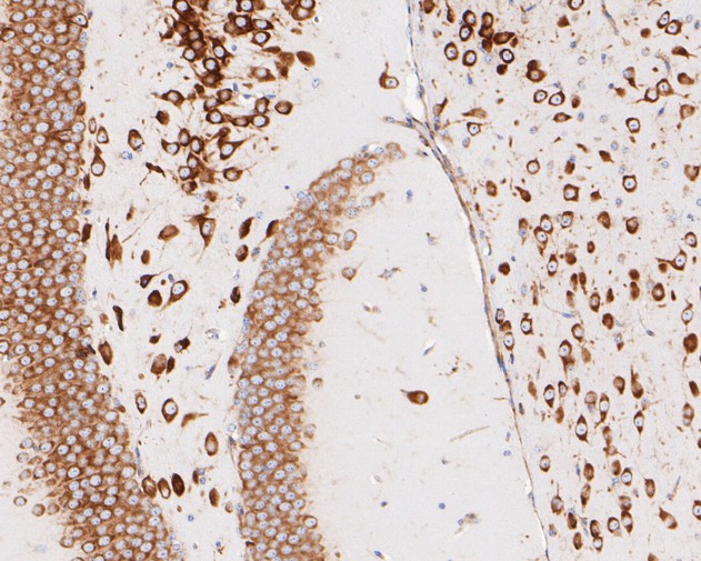 Immunohistochemical analysis of paraffin-embedded mouse brain tissue using anti-RPL7A antibody. The section was pre-treated using heat mediated antigen retrieval with sodium citrate buffer (pH 6.0) for 20 minutes. The tissues were blocked in 5% BSA for 30 minutes at room temperature, washed with ddH2O and PBS, and then probed with the primary antibody (ET7110-70, 1/50)  for 30 minutes at room temperature. The detection was performed using an HRP conjugated compact polymer system. DAB was used as the chromogen. Tissues were counterstained with hematoxylin and mounted with DPX.