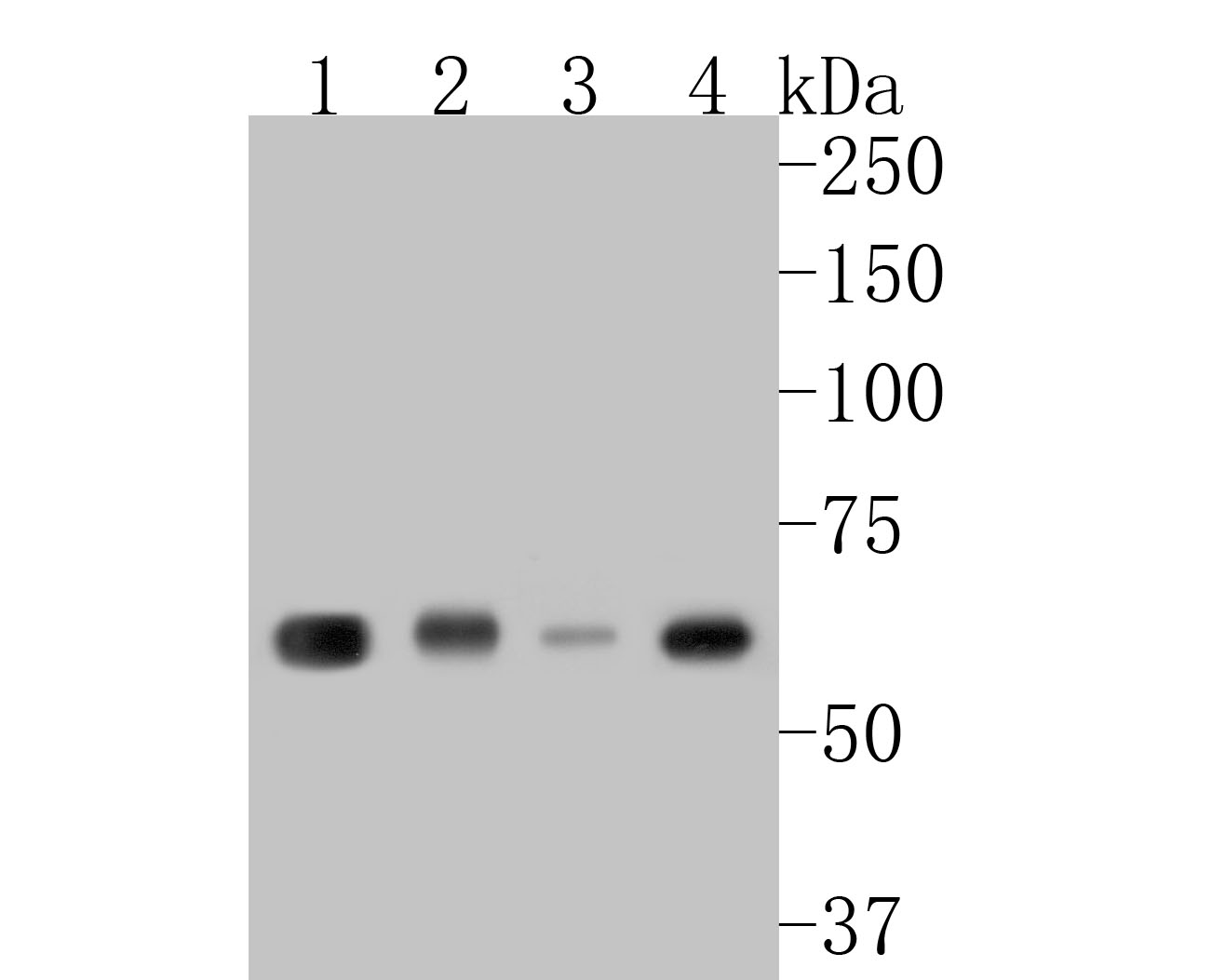 Western blot analysis of KLC1 on different lysates with Rabbit anti-KLC1 antibody (ET7110-72) at 1/500 dilution.<br />
<br />
Lane 1: Human brain tissue lysate (20 µg/Lane)<br />
Lane 2: Rat brain tissue lysate (20 µg/Lane)<br />
Lane 3: Hela cell lysate<br />
Lane 4: PC-12 cell lysate<br />
<br />
Lysates/proteins at 10 µg/Lane.<br />
<br />
Predicted band size: 65 kDa<br />
Observed band size: 65 kDa<br />
<br />
Exposure time: 2 minutes;<br />
<br />
10% SDS-PAGE gel.<br />
<br />
Proteins were transferred to a PVDF membrane and blocked with 5% NFDM/TBST for 1 hour at room temperature. The primary antibody (ET7110-72) at 1/500 dilution was used in 5% NFDM/TBST at room temperature for 2 hours. Goat Anti-Rabbit IgG - HRP Secondary Antibody (HA1001) at 1:5,000 dilution was used for 1 hour at room temperature.