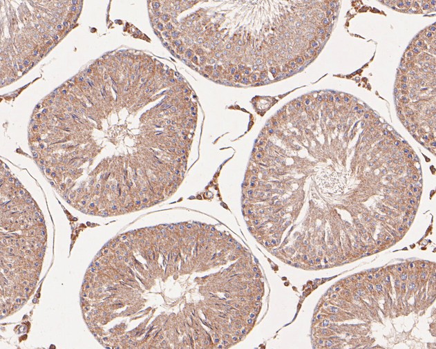 Immunohistochemical analysis of paraffin-embedded rat testis tissue with Rabbit anti-KLC1 antibody (ET7110-72) at 1/50 dilution.<br />
<br />
The section was pre-treated using heat mediated antigen retrieval with Tris-EDTA buffer (pH 8.0-8.4) for 20 minutes. The tissues were blocked in 1% BSA for 20 minutes at room temperature, washed with ddH2O and PBS, and then probed with the primary antibody (ET7110-72) at 1/50 dilution for 0.5 hour at room temperature. The detection was performed using an HRP conjugated compact polymer system. DAB was used as the chromogen. Tissues were counterstained with hematoxylin and mounted with DPX.