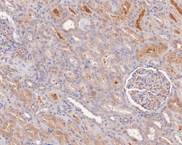 Immunohistochemical analysis of paraffin-embedded human kidney tissue with Rabbit anti-KLC1 antibody (ET7110-72) at 1/200 dilution.<br />
<br />
The section was pre-treated using heat mediated antigen retrieval with Tris-EDTA buffer (pH 8.0-8.4) for 20 minutes. The tissues were blocked in 1% BSA for 20 minutes at room temperature, washed with ddH2O and PBS, and then probed with the primary antibody (ET7110-72) at 1/200 dilution for 0.5 hour at room temperature. The detection was performed using an HRP conjugated compact polymer system. DAB was used as the chromogen. Tissues were counterstained with hematoxylin and mounted with DPX.