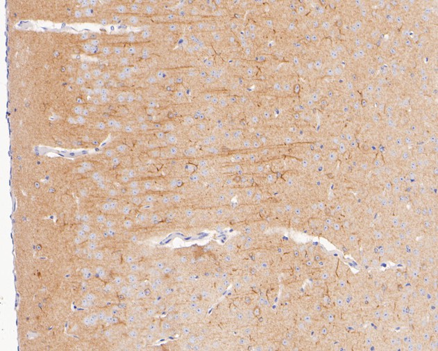 Immunohistochemical analysis of paraffin-embedded mouse brain tissue with Rabbit anti-KLC1 antibody (ET7110-72) at 1/400 dilution.<br />
<br />
The section was pre-treated using heat mediated antigen retrieval with Tris-EDTA buffer (pH 8.0-8.4) for 20 minutes. The tissues were blocked in 1% BSA for 20 minutes at room temperature, washed with ddH2O and PBS, and then probed with the primary antibody (ET7110-72) at 1/400 dilution for 0.5 hour at room temperature. The detection was performed using an HRP conjugated compact polymer system. DAB was used as the chromogen. Tissues were counterstained with hematoxylin and mounted with DPX.