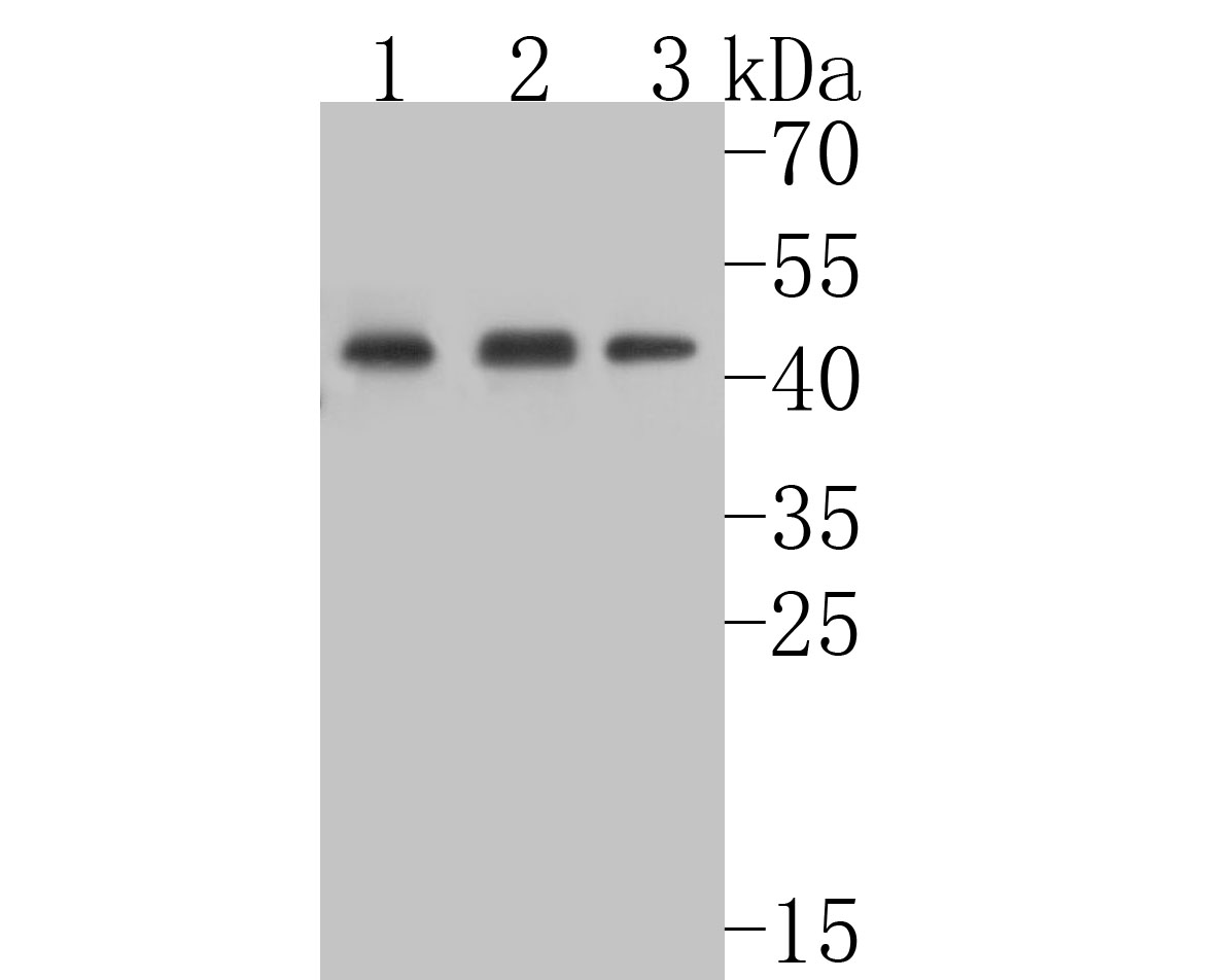 Western blot analysis of TNFRSF19 on different lysates with Rabbit anti-TNFRSF19 antibody (ET7110-74) at 1/500 dilution.<br />
<br />
Lane 1: mouse testis tissue lysate(20 µg/Lane)<br />
Lane 2: rat large intestine tissue lysate (20 µg/Lane)<br />
Lane 3: A431 cell lysate<br />
<br />
Lysates/proteins at 10 µg/Lane.<br />
<br />
Predicted band size: 46 kDa<br />
Observed band size: 46 kDa<br />
<br />
Exposure time: 1 minutes;<br />
<br />
12% SDS-PAGE gel.<br />
<br />
Proteins were transferred to a PVDF membrane and blocked with 5% NFDM/TBST for 1 hour at room temperature. The primary antibody (ET7110-74) at 1/500 dilution was used in 5% NFDM/TBST at room temperature for 2 hours. Goat Anti-Rabbit IgG - HRP Secondary Antibody (HA1001) at 1:5,000 dilution was used for 1 hour at room temperature.
