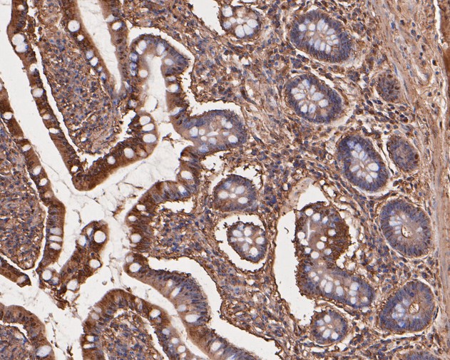 Immunohistochemical analysis of paraffin-embedded human small intestine tissue with Rabbit anti-TNFRSF19 antibody (ET7110-74) at 1/50 dilution.<br />
<br />
The section was pre-treated using heat mediated antigen retrieval with Tris-EDTA buffer (pH 8.0-8.4) for 20 minutes. The tissues were blocked in 1% BSA for 20 minutes at room temperature, washed with ddH2O and PBS, and then probed with the primary antibody (ET7110-74) at 1/50 dilution for 0.5 hour at room temperature. The detection was performed using an HRP conjugated compact polymer system. DAB was used as the chromogen. Tissues were counterstained with hematoxylin and mounted with DPX.
