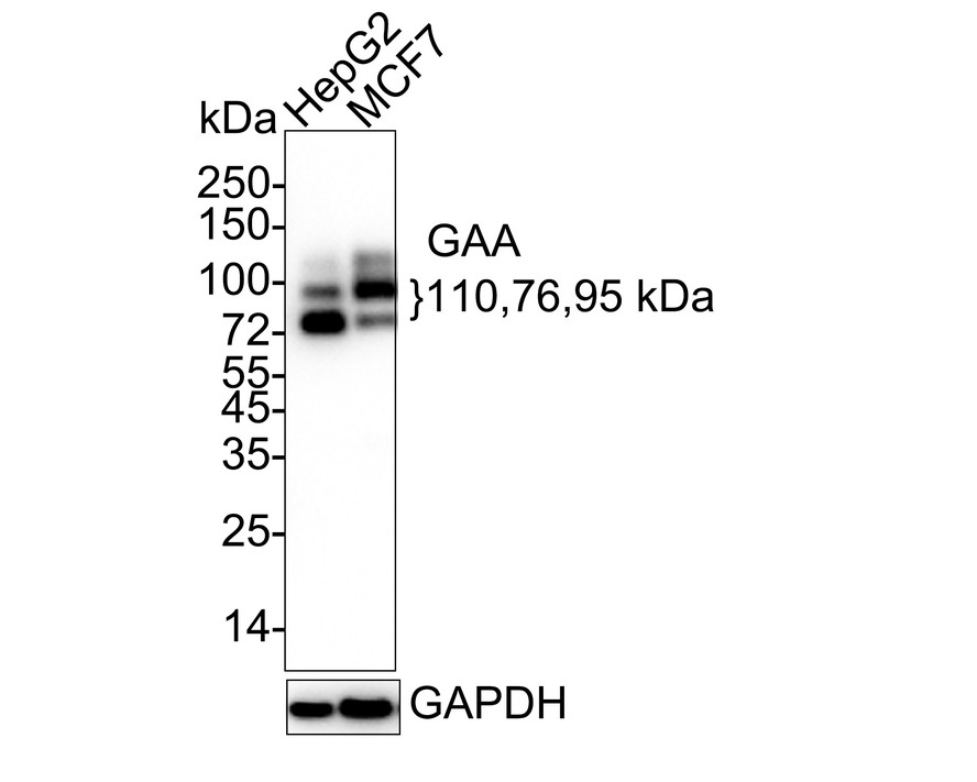 Western blot analysis of GAA on different lysates with Rabbit anti-GAA antibody (ET7110-77) at 1/500 dilution.<br />
<br />
Lane 1: HepG2 cell lysate<br />
Lane 2: MCF-7 cell lysate<br />
Lane 3: Human placenta tissue lysate(20 µg/Lane)<br />
<br />
Lysates/proteins at 10 µg/Lane.<br />
<br />
Predicted band size: 105/76/70 kDa<br />
Observed band size: 99/76 kDa<br />
<br />
Exposure time: 2 minutes;<br />
<br />
6% SDS-PAGE gel.<br />
<br />
Proteins were transferred to a PVDF membrane and blocked with 5% NFDM/TBST for 1 hour at room temperature. The primary antibody (ET7110-77) at 1/1,000 dilution was used in 5% NFDM/TBST at room temperature for 2 hours. Goat Anti-Rabbit IgG - HRP Secondary Antibody (HA1001) at 1:200,000 dilution was used for 1 hour at room temperature.