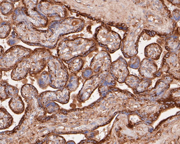 Immunohistochemical analysis of paraffin-embedded human placenta tissue with Rabbit anti-GAA antibody (ET7110-77) at 1/50 dilution.<br />
<br />
The section was pre-treated using heat mediated antigen retrieval with Tris-EDTA buffer (pH 9.0) for 20 minutes. The tissues were blocked in 1% BSA for 20 minutes at room temperature, washed with ddH2O and PBS, and then probed with the primary antibody (ET7110-77) at 1/50 dilution for 0.5 hour at room temperature. The detection was performed using an HRP conjugated compact polymer system. DAB was used as the chromogen. Tissues were counterstained with hematoxylin and mounted with DPX.