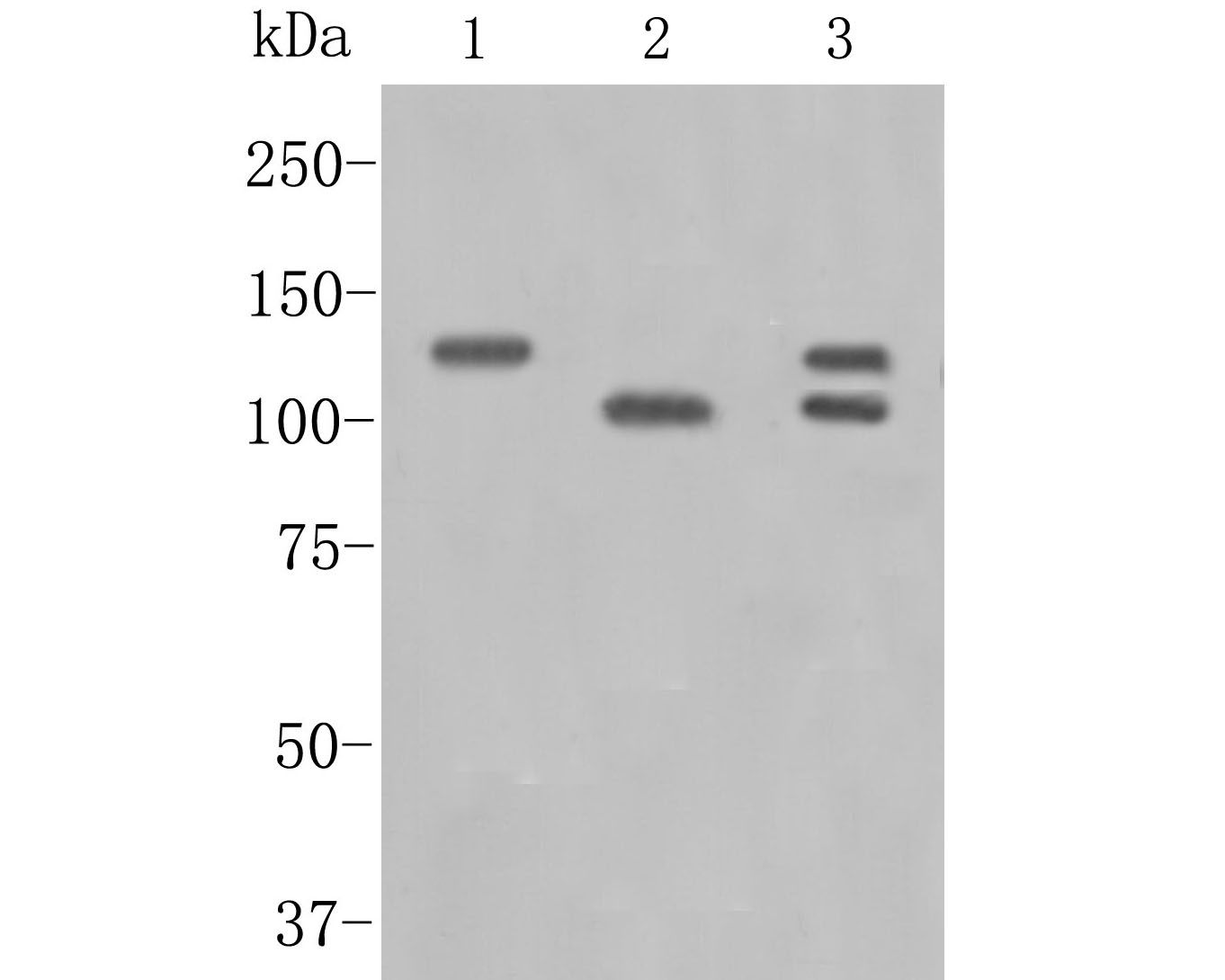 Immunohistochemical analysis of paraffin-embedded rat testis tissue with Rabbit anti-APLP2 antibody (ET7110-78) at 1/50 dilution.<br />
<br />
The section was pre-treated using heat mediated antigen retrieval with sodium citrate buffer (pH 6.0) for 2 minutes. The tissues were blocked in 1% BSA for 20 minutes at room temperature, washed with ddH2O and PBS, and then probed with the primary antibody (ET7110-78) at 1/50 dilution for 1 hour at room temperature. The detection was performed using an HRP conjugated compact polymer system. DAB was used as the chromogen. Tissues were counterstained with hematoxylin and mounted with DPX.