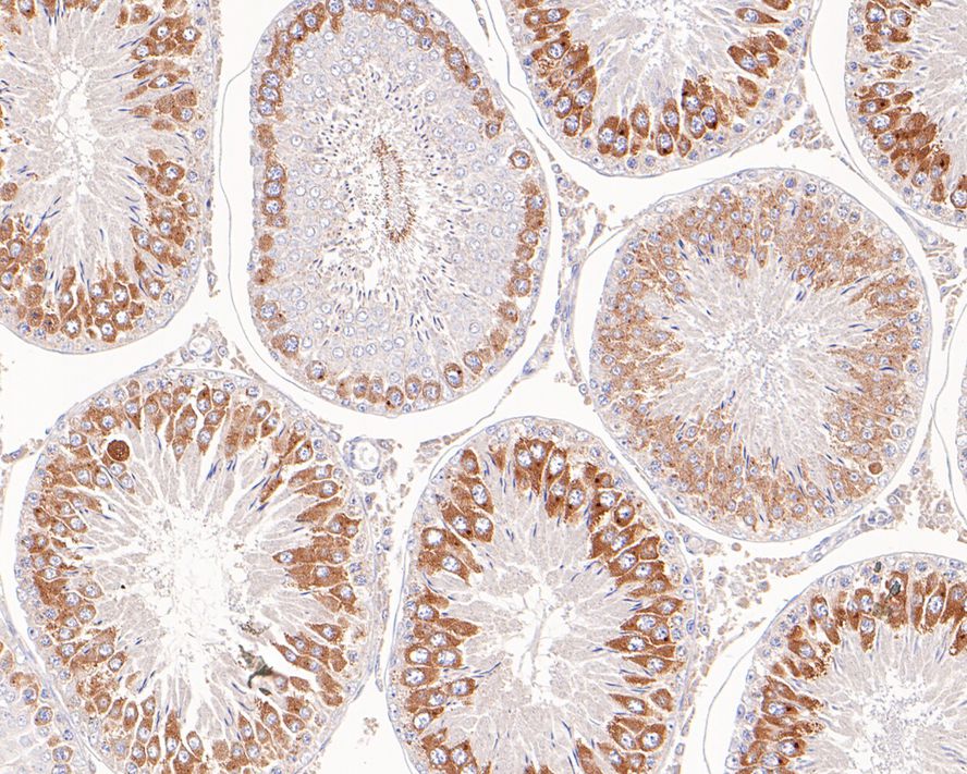 Immunohistochemical analysis of paraffin-embedded human kidney tissue with Rabbit anti-APLP2 antibody (ET7110-78) at 1/50 dilution.<br />
<br />
The section was pre-treated using heat mediated antigen retrieval with sodium citrate buffer (pH 6.0) for 2 minutes. The tissues were blocked in 1% BSA for 20 minutes at room temperature, washed with ddH2O and PBS, and then probed with the primary antibody (ET7110-78) at 1/50 dilution for 1 hour at room temperature. The detection was performed using an HRP conjugated compact polymer system. DAB was used as the chromogen. Tissues were counterstained with hematoxylin and mounted with DPX.