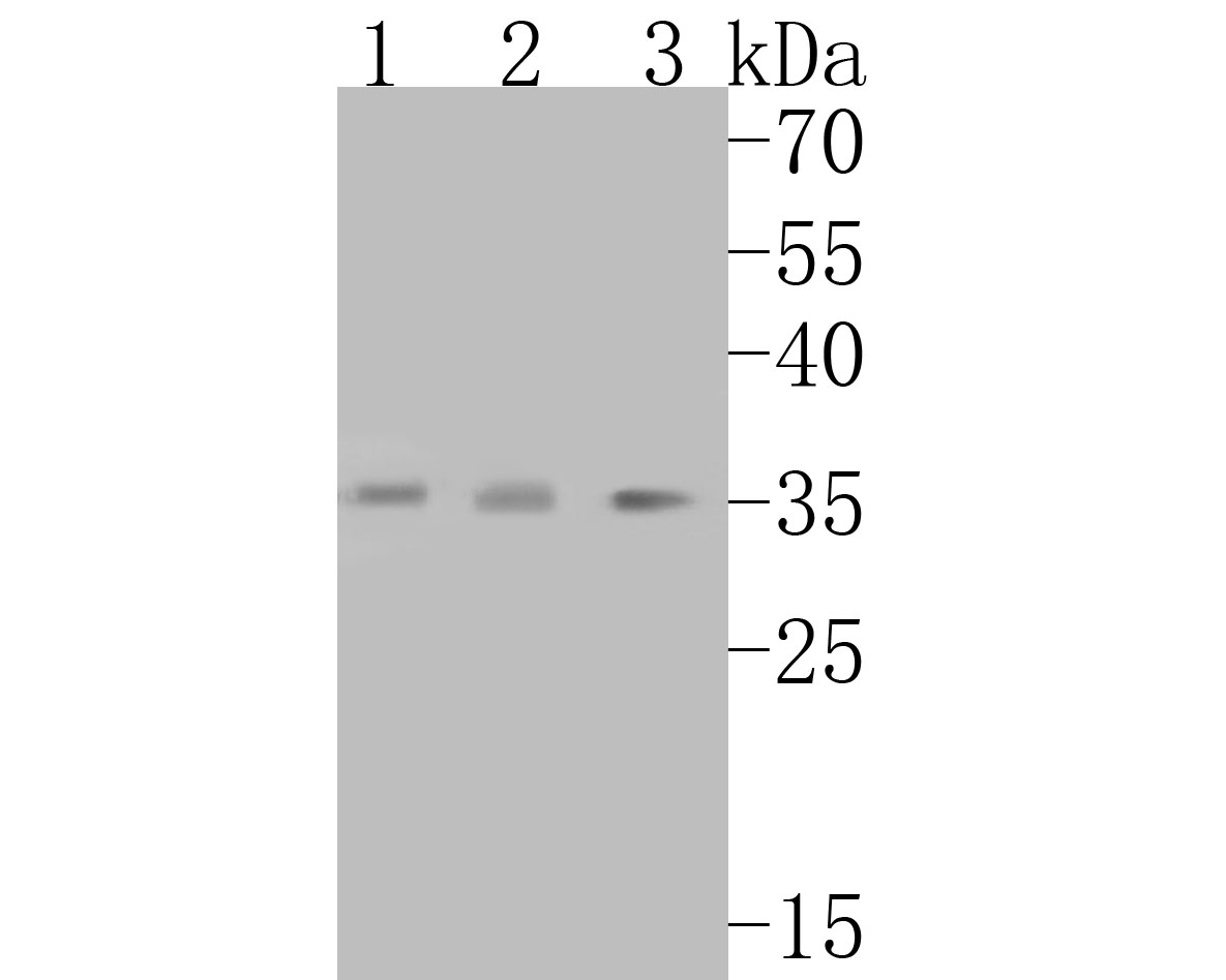 Western blot analysis of Alpha SNAP on different lysates with Rabbit anti-Alpha SNAP antibody (ET7110-79) at 1/500 dilution.<br />
<br />
Lane 1: Human placenta tissue lysate(20 µg/Lane)<br />
Lane 2: Mouse testis tissue lysate 20 µg/Lane.<br />
Lane 3: SH-SY5Y cell lysate<br />
<br />
Lysates/proteins at 10 µg/Lane.<br />
<br />
Predicted band size: 33 kDa<br />
Observed band size: 35 kDa<br />
<br />
Exposure time: 2 minutes;<br />
<br />
12% SDS-PAGE gel.<br />
<br />
Proteins were transferred to a PVDF membrane and blocked with 5% NFDM/TBST for 1 hour at room temperature. The primary antibody (ET7110-79) at 1/1,000 dilution was used in 5% NFDM/TBST at room temperature for 2 hours. Goat Anti-Rabbit IgG - HRP Secondary Antibody (HA1001) at 1:5,000 dilution was used for 1 hour at room temperature.