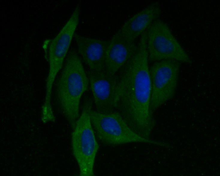 ICC staining of Alpha SNAP in SiHa cells (green). Formalin fixed cells were permeabilized with 0.1% Triton X-100 in TBS for 10 minutes at room temperature and blocked with 1% Blocker BSA for 15 minutes at room temperature. Cells were probed with the primary antibody (ET7110-79, 1/100) for 1 hour at room temperature, washed with PBS. Alexa Fluor®488 Goat anti-Rabbit IgG was used as the secondary antibody at 1/1,000 dilution. The nuclear counter stain is DAPI (blue).