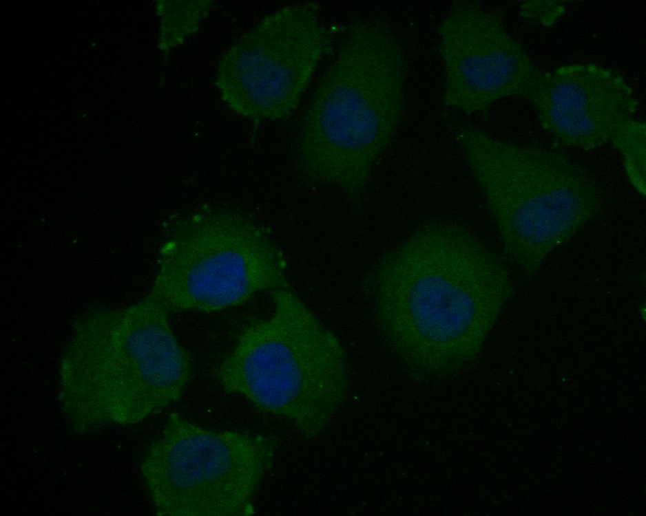 Immunocytochemistry analysis of HUVEC cells labeling VEGFD with Rabbit anti-VEGFD antibody (ET7110-81) at 1/100 dilution.<br />
<br />
Cells were fixed in 4% paraformaldehyde for 10 minutes at 37 ℃, permeabilized with 0.05% Triton X-100 in PBS for 20 minutes, and then blocked with 2% negative goat serum for 30 minutes at room temperature. Cells were then incubated with Rabbit anti-VEGFD antibody (ET7110-81) at 1/100 dilution in 2% negative goat serum overnight at 4 ℃.Alexa Fluor®488 Goat anti-Rabbit IgG  was used as the secondary antibody at 1/1,000 dilution.Nuclear DNA was labelled in blue with DAPI.