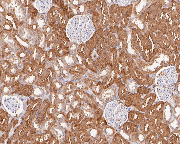Immunohistochemical analysis of paraffin-embedded rat kidney tissue with Rabbit anti-VEGFD antibody (ET7110-81) at 1/200 dilution.<br />
<br />
The section was pre-treated using heat mediated antigen retrieval with Tris-EDTA buffer (pH 8.0-8.4) for 20 minutes. The tissues were blocked in 1% BSA for 20 minutes at room temperature, washed with ddH2O and PBS, and then probed with the primary antibody (ET7110-81) at 1/200 dilution for 0.5 hour at room temperature. The detection was performed using an HRP conjugated compact polymer system. DAB was used as the chromogen. Tissues were counterstained with hematoxylin and mounted with DPX.
