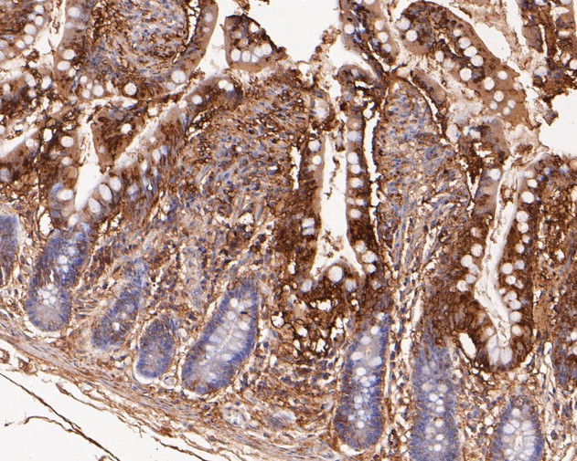 Immunohistochemical analysis of paraffin-embedded human small intestine tissue with Rabbit anti-VEGFD antibody (ET7110-81) at 1/200 dilution.<br />
<br />
The section was pre-treated using heat mediated antigen retrieval with Tris-EDTA buffer (pH 8.0-8.4) for 20 minutes. The tissues were blocked in 1% BSA for 20 minutes at room temperature, washed with ddH2O and PBS, and then probed with the primary antibody (ET7110-81) at 1/200 dilution for 0.5 hour at room temperature. The detection was performed using an HRP conjugated compact polymer system. DAB was used as the chromogen. Tissues were counterstained with hematoxylin and mounted with DPX.