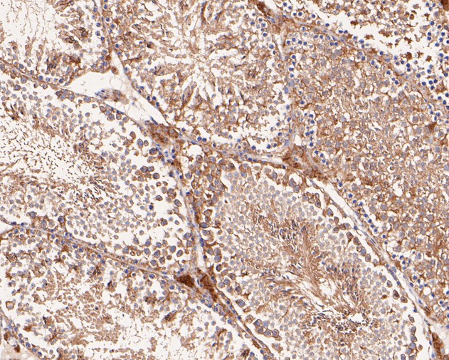 Immunohistochemical analysis of paraffin-embedded mouse testis tissue with Rabbit anti-VEGFD antibody (ET7110-81) at 1/50 dilution.<br />
<br />
The section was pre-treated using heat mediated antigen retrieval with Tris-EDTA buffer (pH 8.0-8.4) for 20 minutes. The tissues were blocked in 1% BSA for 20 minutes at room temperature, washed with ddH2O and PBS, and then probed with the primary antibody (ET7110-81) at 1/50 dilution for 0.5 hour at room temperature. The detection was performed using an HRP conjugated compact polymer system. DAB was used as the chromogen. Tissues were counterstained with hematoxylin and mounted with DPX.