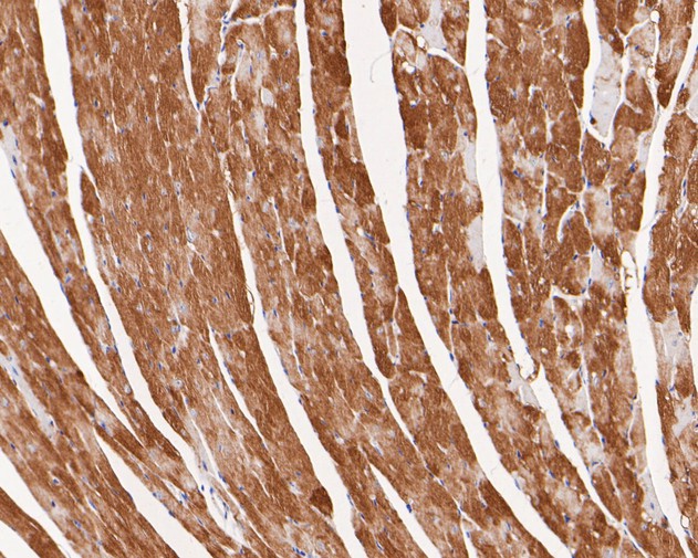 Immunohistochemical analysis of paraffin-embedded mouse heart tissue with Rabbit anti-VEGFD antibody (ET7110-81) at 1/200 dilution.<br />
<br />
The section was pre-treated using heat mediated antigen retrieval with Tris-EDTA buffer (pH 8.0-8.4) for 20 minutes. The tissues were blocked in 1% BSA for 20 minutes at room temperature, washed with ddH2O and PBS, and then probed with the primary antibody (ET7110-81) at 1/200 dilution for 0.5 hour at room temperature. The detection was performed using an HRP conjugated compact polymer system. DAB was used as the chromogen. Tissues were counterstained with hematoxylin and mounted with DPX.