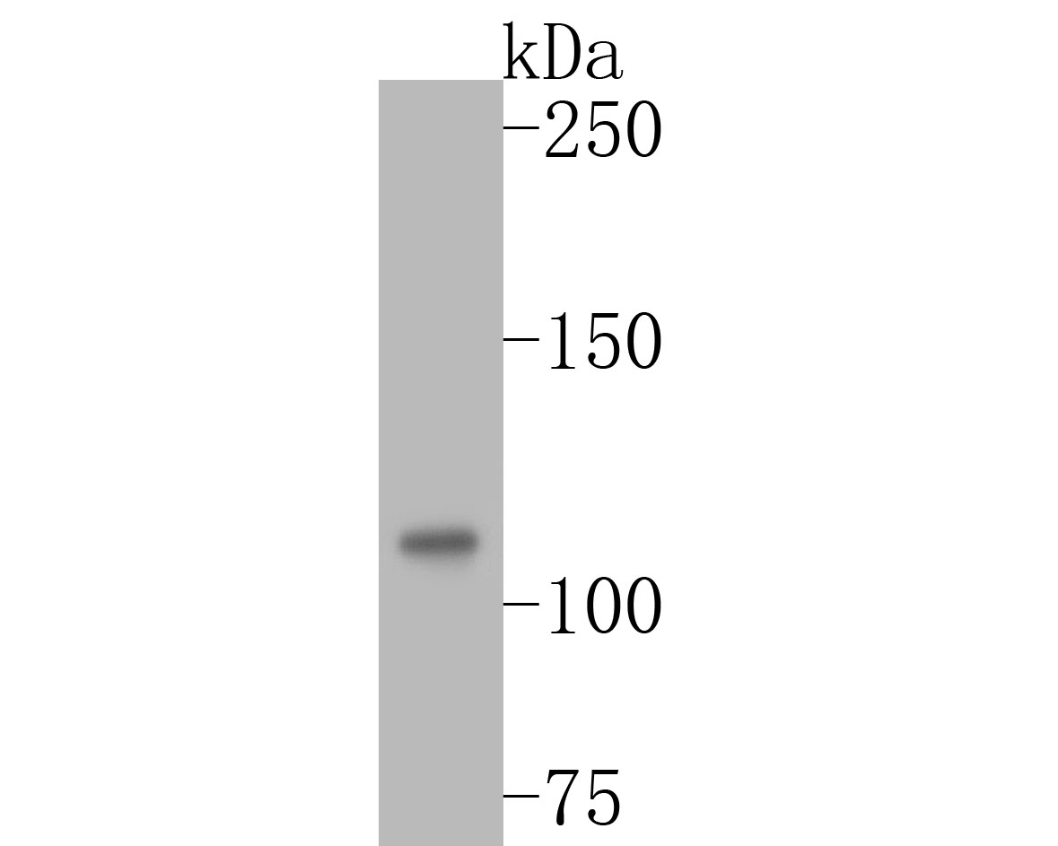 Western blot analysis of DPYD on SiHa cell lysates with Rabbit anti-DPYD antibody (ET7110-83) at 1/500 dilution.<br />
<br />
Lysates/proteins at 10 µg/Lane.<br />
<br />
Predicted band size: 111 kDa<br />
Observed band size: 111 kDa<br />
<br />
Exposure time: 2 minutes;<br />
<br />
6% SDS-PAGE gel.<br />
<br />
Proteins were transferred to a PVDF membrane and blocked with 5% NFDM/TBST for 1 hour at room temperature. The primary antibody (ET7110-83) at 1/500 dilution was used in 5% NFDM/TBST at room temperature for 2 hours. Goat Anti-Rabbit IgG - HRP Secondary Antibody (HA1001) at 1:5,000 dilution was used for 1 hour at room temperature.