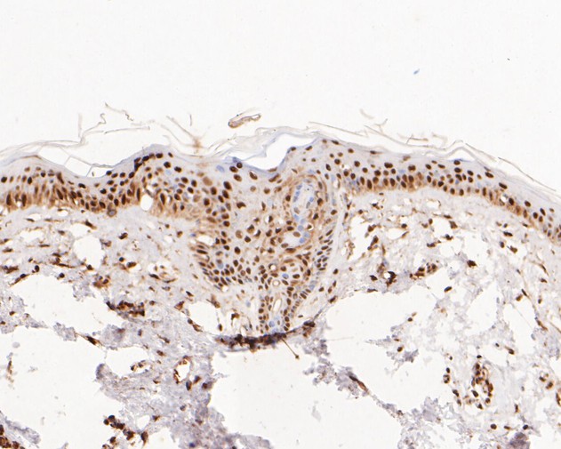 Immunohistochemical analysis of paraffin-embedded human skin tissue using anti-NFYA antibody. The section was pre-treated using heat mediated antigen retrieval with sodium citrate buffer (pH 6.0) for 20 minutes. The tissues were blocked in 5% BSA for 30 minutes at room temperature, washed with ddH2O and PBS, and then probed with the primary antibody (ET7110-85, 1/100)  for 30 minutes at room temperature. The detection was performed using an HRP conjugated compact polymer system. DAB was used as the chromogen. Tissues were counterstained with hematoxylin and mounted with DPX.